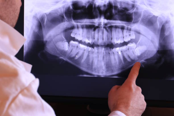 Best Emergency Treatment for Toothache in Kingstowne, VA