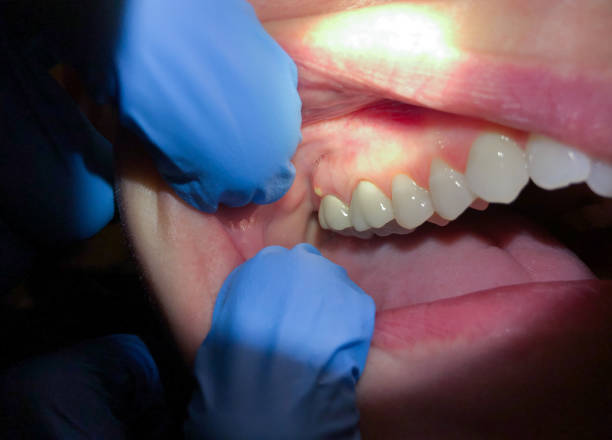 Best Same-Day Emergency Dentist in Kingstowne, VA