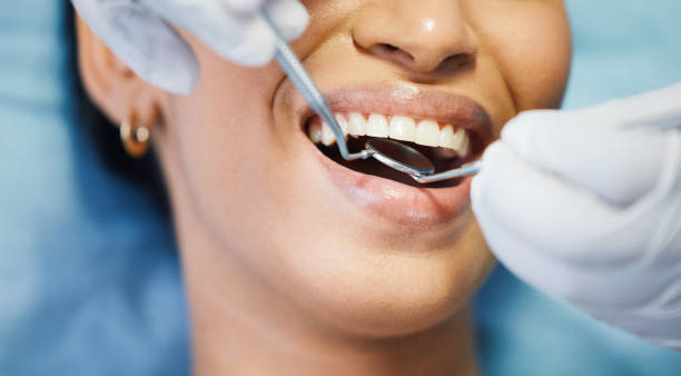 Best Emergency Treatment for Toothache in Kingstowne, VA