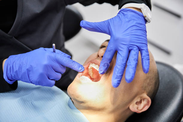 Best Emergency Dental Surgery in Kingstowne, VA